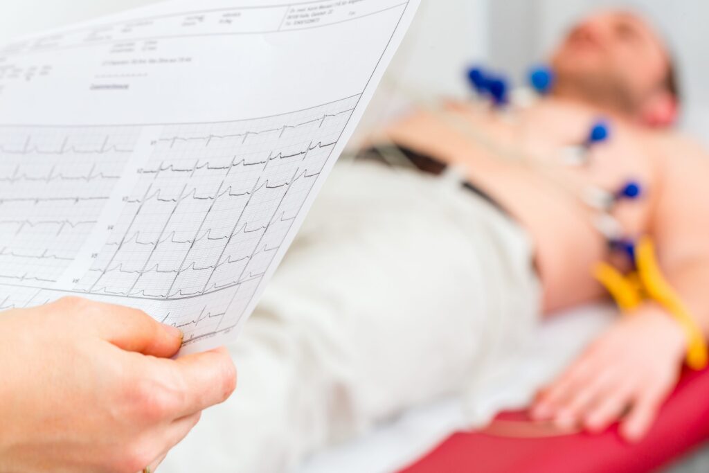closeup of EKG report and man laying on exam table in background